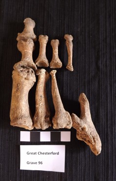Great Chesterton Skeletal Remains